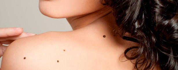 prevenzione dermatologica aprile 2015